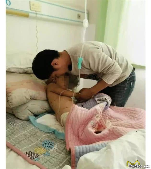 又一起狗伤人事件，为了更好地避免孩子遭受损害，主人务必要了解的