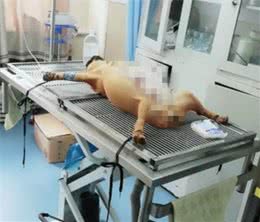 狗狗难产，被送去做剖腹产，看到手术室的画面，当妈都不容易
