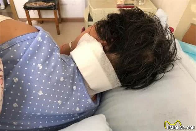 女子被养了5年的狗咬得血肉恍惚已经不是第一次
