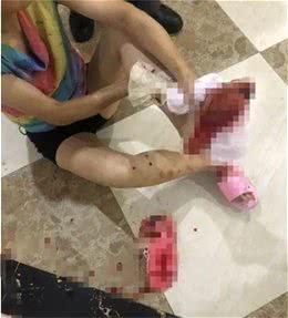 狗伤人，狗主人应当承担什么法律责任？后果很严重遛狗请牵绳