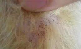 狗狗身上有跳蚤与虱子怎么办，用这几招轻松驱除，保护狗狗健康