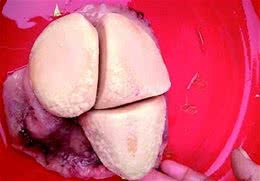 狗腹中藏三块“狗宝”？专家：需对实物进行鉴定