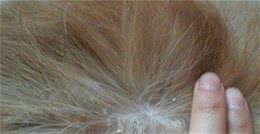 狗狗身上有大量皮屑真的很难去掉吗？不妨试试这6个方法