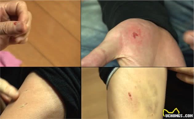 小狗不爱看人“握手”，逼得家人不能同桌吃饭，一家人都被它咬过