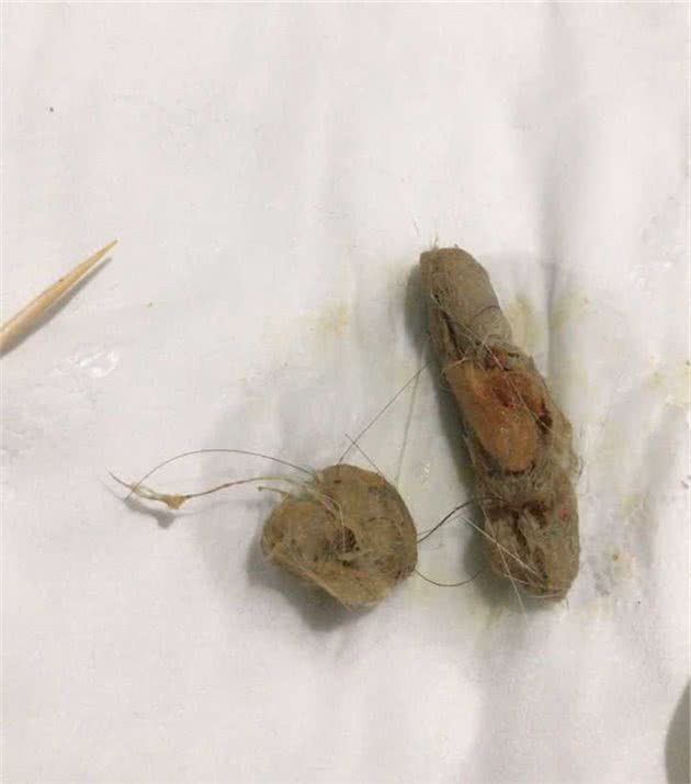 猫咪呕吐该怎么办？对照猫咪呕吐的6种情况，再判断是否需要就医