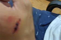 毫无征兆的攻击！柯基看似淡定自若，下秒把训犬师咬得鲜血淋漓
