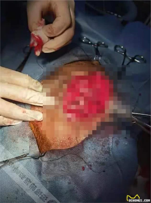 马犬被人恶意扔在门口，背部严重烫伤，洗澡洗出一盆蛆虫