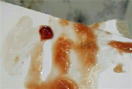 狗狗拉稀很臭反复拉稀拉血便怎么办？拉稀需要做的事情都在这里了