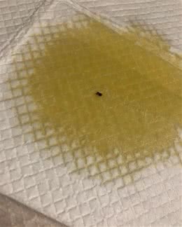 狗狗尿血块是什么情况？（附常见病因及治疗方法）