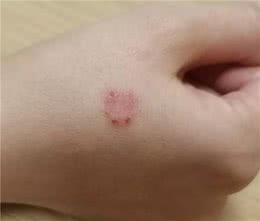 养宠物容易得的皮肤病
