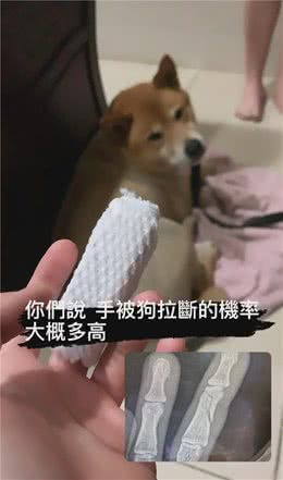 狗子一个爆冲把主人手指拉断…铲屎官：“它太胖了！”