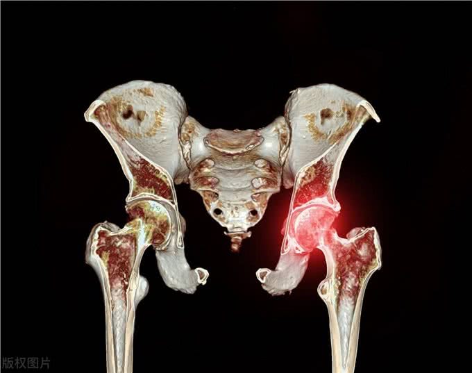 水上的刀锋战士：带你深入了解爱尔兰水猎犬!