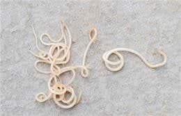 辟谣：狗感染蛔虫只会引起拉稀?这些致命疾病才是蛔虫的真实危害