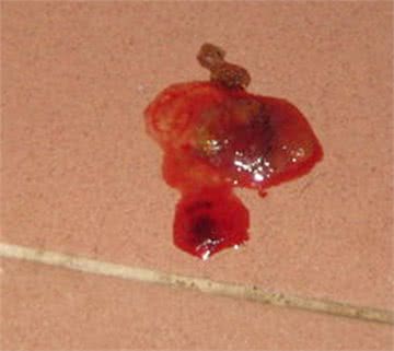 狗狗食物中毒以后会有什么症状，预防措施有哪些?