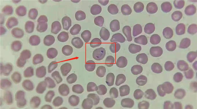 能引起狗狗重度贫血的寄生虫—巴贝斯虫
