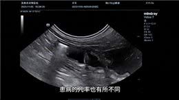 狗狗的子宫蓄脓是怎么回事?