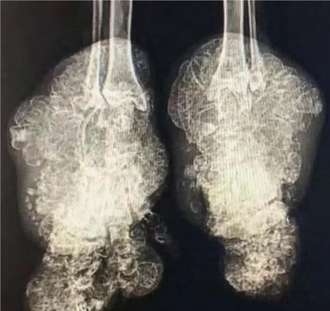 有的折耳猫不会发病?胡扯,永远别碰折耳猫