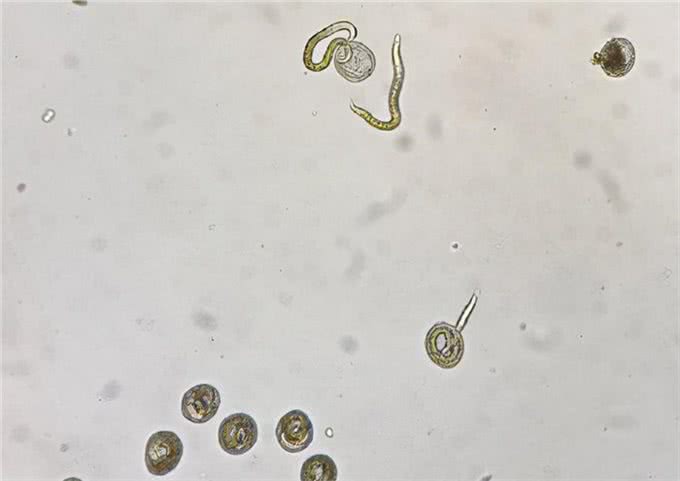 警惕!宠物犬一定要驱虫养犬男孩眼睛里发现寄生虫