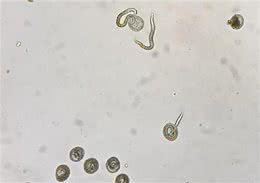 警惕!宠物犬一定要驱虫养犬男孩眼睛里发现寄生虫