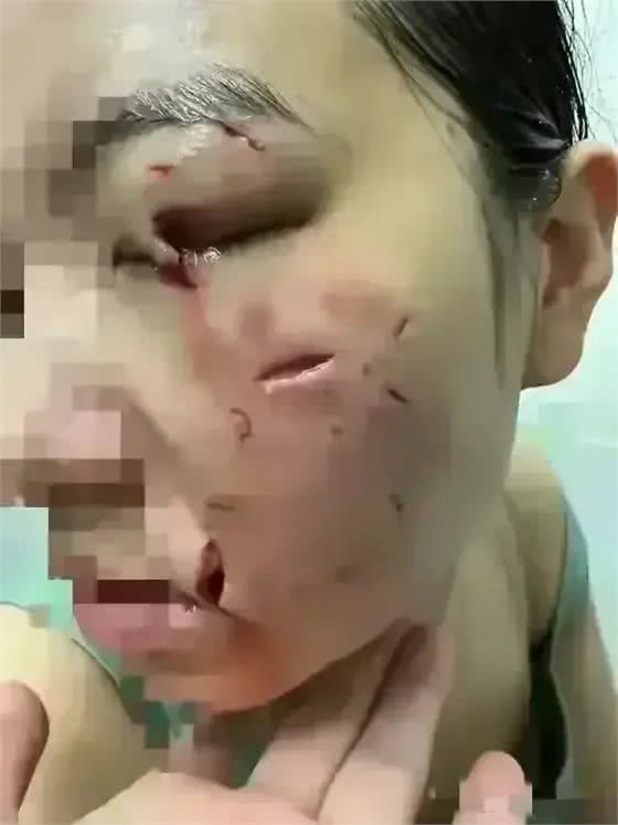 街头温馨瞬间突变惊魂!女子爱抚可爱松狮犬，却遭突袭脸鲜血直流