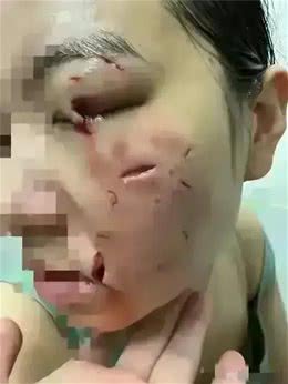 街头温馨瞬间突变惊魂!女子爱抚可爱松狮犬，却遭突袭脸鲜血直流