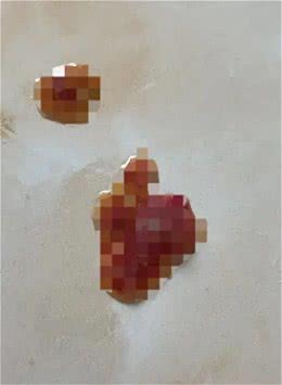 要重视起来!狗狗肠胃损伤其实离我们不远!