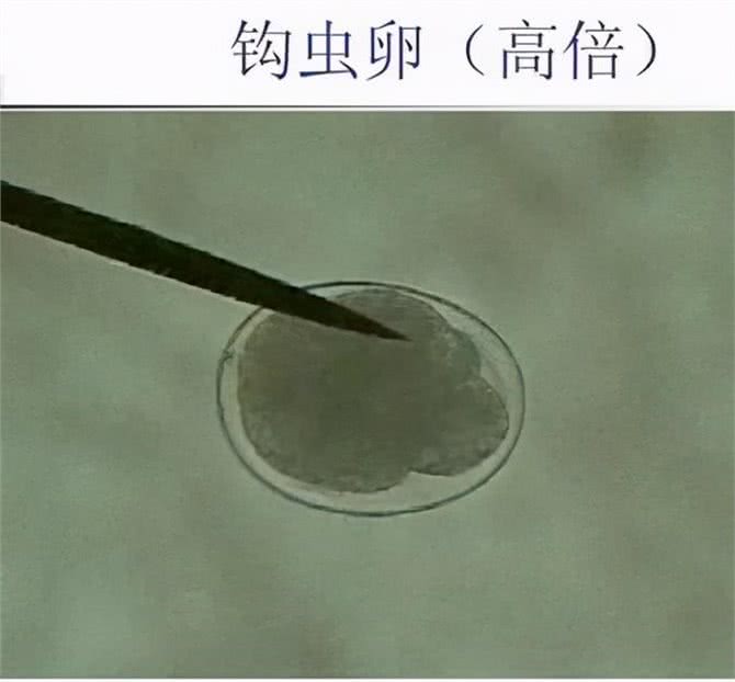 犬猫常见的寄生虫病，铲屎官要警惕