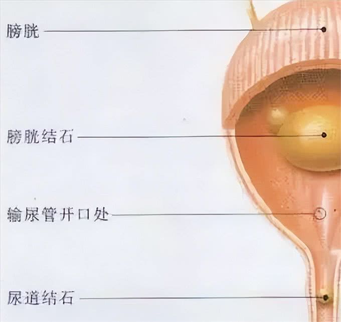 狗狗泌尿系统结石?别着急，看了就懂