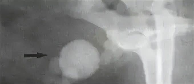 狗狗泌尿系统结石?别着急，看了就懂