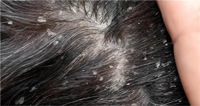 狗身上寄生虫太可怕了，尤其是这5种，头皮发麻，一定要及时防治
