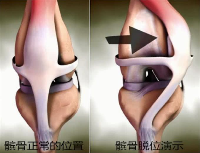 任何年龄、品种的狗都有可能患这个病，老了才发现就晚了