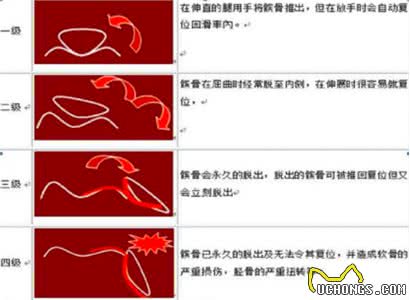 任何年龄、品种的狗都有可能患这个病，老了才发现就晚了