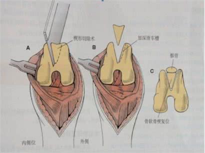 任何年龄、品种的狗都有可能患这个病，老了才发现就晚了