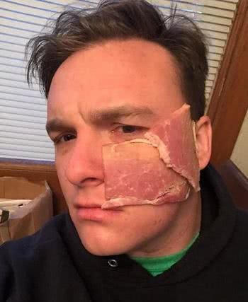 狗狗脸部大面积烧伤让人心疼，仔细再看一次才发现眼泪白流了