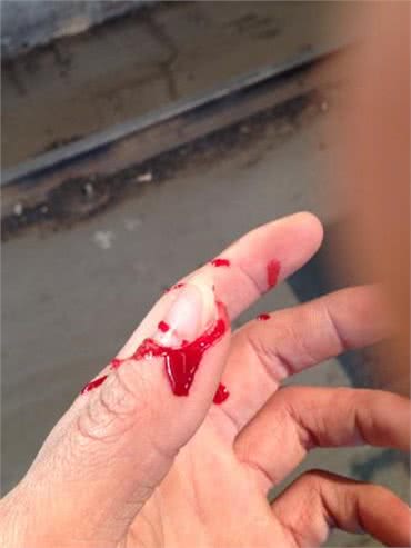 狗狗咬人怎么办?6个小步骤轻松解决!