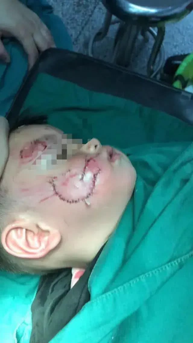 强烈建议立法:对宠物狗出门不拴绳的，依法捕杀，并对狗主人严惩